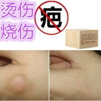 Remove cigarette pimples remove burns bumps scars and marks on men and womens chin lighten laser melanin pigmentation ointment products