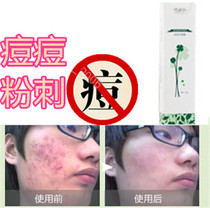 Products for repairing acne scars acne marks acne scars acne pits adolescent acne acne dilution acne scars acne for men and women