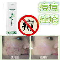 Remove blackheads closed acne scars acne products for men and women acne acne bean repair cream for children