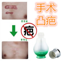 Pimple removal childrens hypertrophic bulge surgery cesarean section scar tattoo stitches scratch fall and double eyelid injury