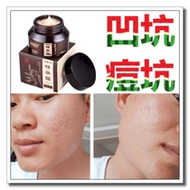 Poudre congelée déflecteur pimple pimple pimple potholes grossières grossières pores grossiers Masque de visage japonais à femme outil de réparation