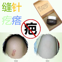 Removes surgical repair ointment to remove hypertrophic bumps removes uterine rupture and childbirth scars Yinling fades stitches removes falls