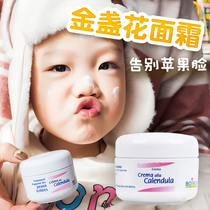 French boiron Bao Hongjin Flower Face Cream Baby Boy Ice Cream Face Cream Baby Go Red Apple Face No Hormone