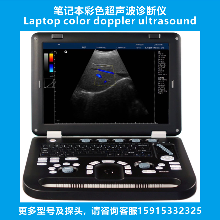 Veterinary laptop ultrasound machine, pet ultrasound diagnostic instrument - .com