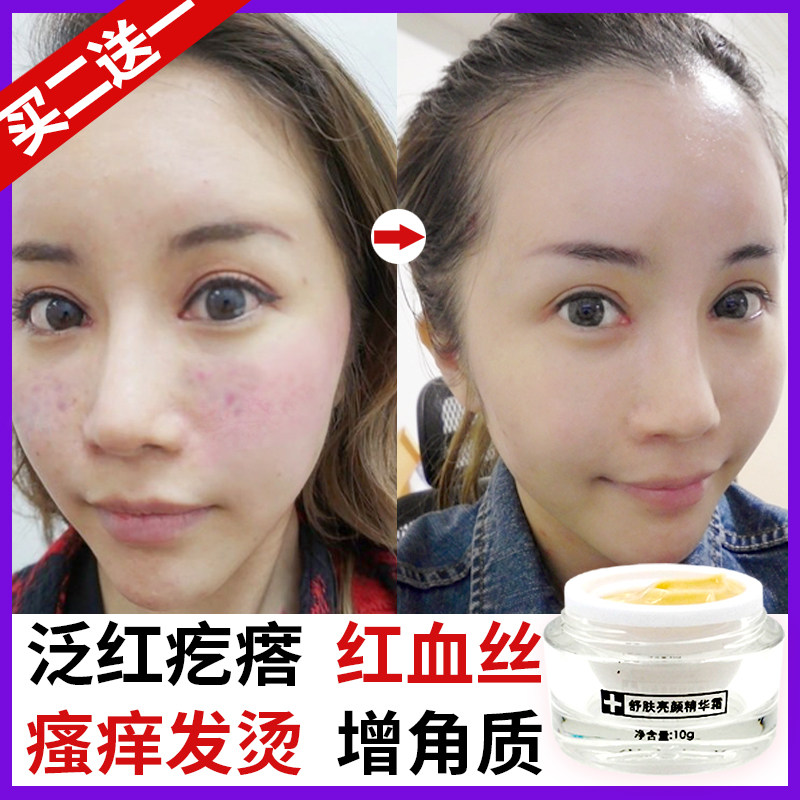 Baoli Skin exfoliation helps red bloodshot Apply nuns to thicken the cuticle Sensitive skin Special cream for men