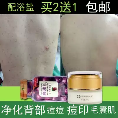 Back helps acne cream to go to the body, chest, mouth, bath salt to go to the back, acne cream, acne marks, skin care products