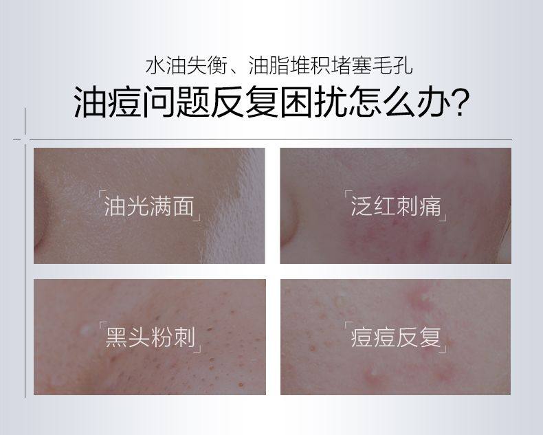 【香港直郵】 薇諾娜 複合水楊酸煥顏精華30ml 專為敏感肌研發 溫和刷酸 祛痘閉口 舒緩保濕