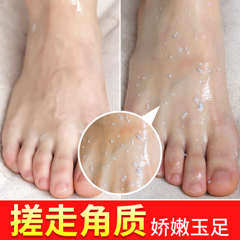足部去角质霜去死皮脚后跟去老茧磨砂膏啫喱光滑保湿脚部护理嫩脚