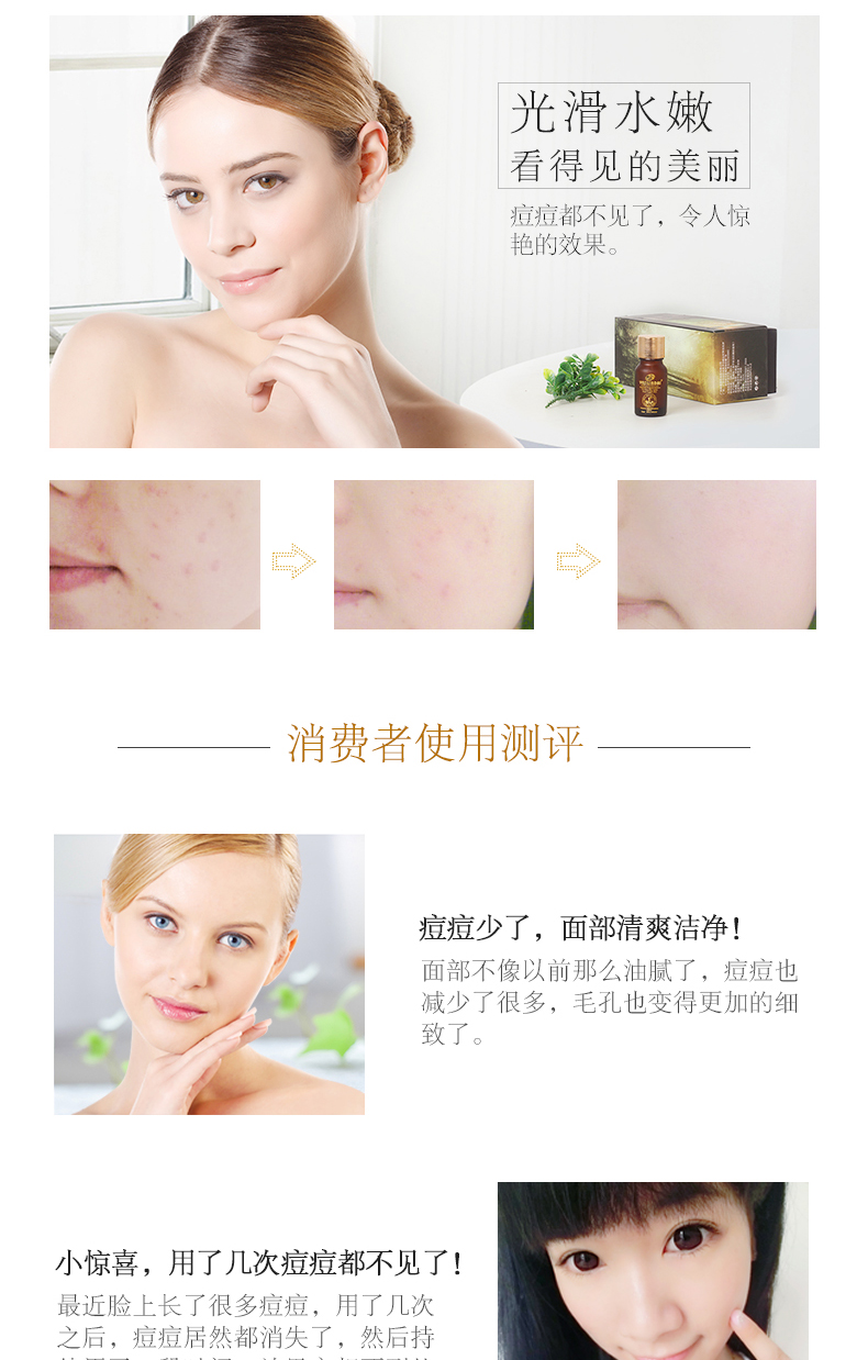 Ya Si Sheng Tea Tree Essential Oil 10ml Hương liệu thực vật đơn phương Tinh dầu thơm Hương liệu trị mụn tinh dầu xông phòng