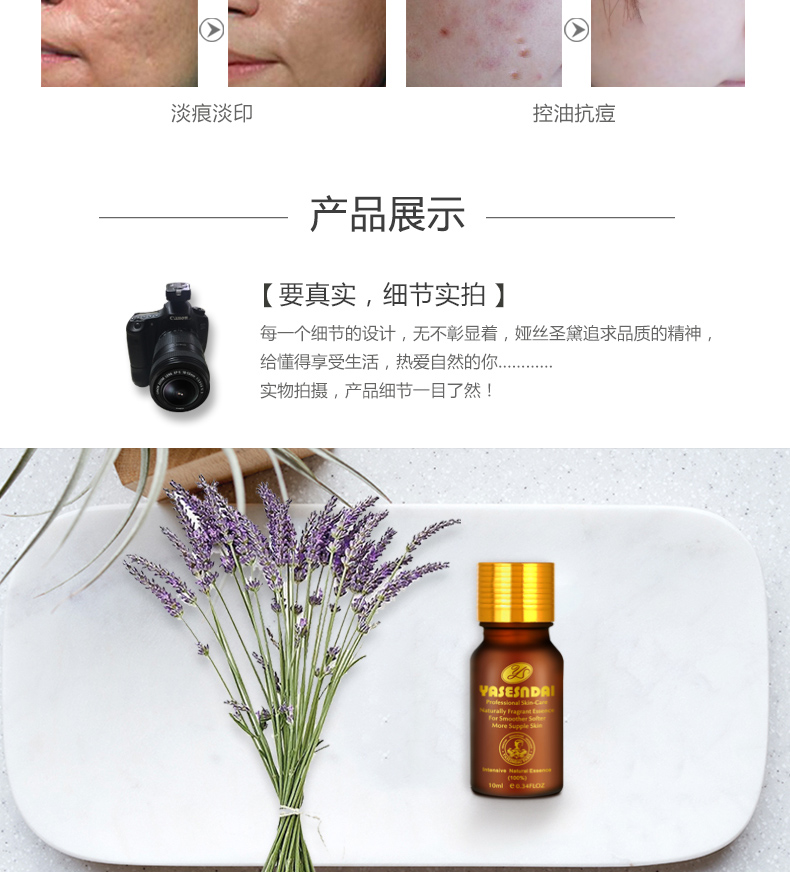 Tinh dầu oải hương 10ml tinh dầu thực vật đơn phương tinh dầu trị liệu dầu thơm trị mụn trứng cá kiểm soát lỗ chân lông tinh dầu nguyên chất
