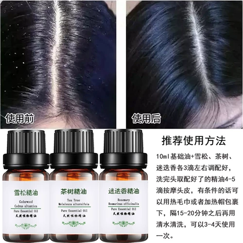 Эссенция чайного дерева с розмарином, натуральное массажное масло для кожи головы, кондиционер, 20 мл, контроль жирного блеска