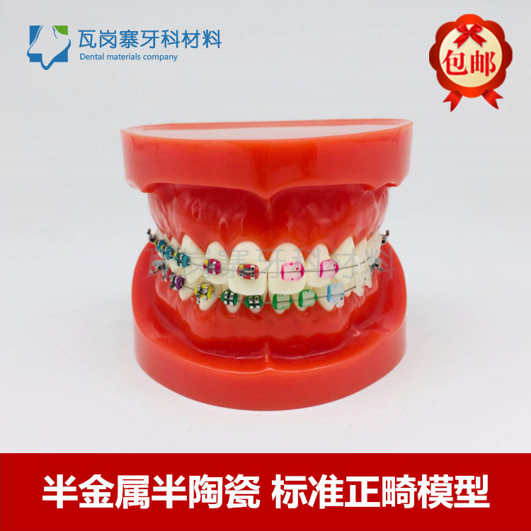 牙科口腔正畸模型 半金属半陶瓷正畸牙模 牙列整齐矫正 医患沟通