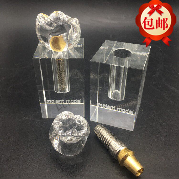 牙科材料 水晶种植体模型 大水晶 可拆卸口腔教学 牙科饰品 包邮