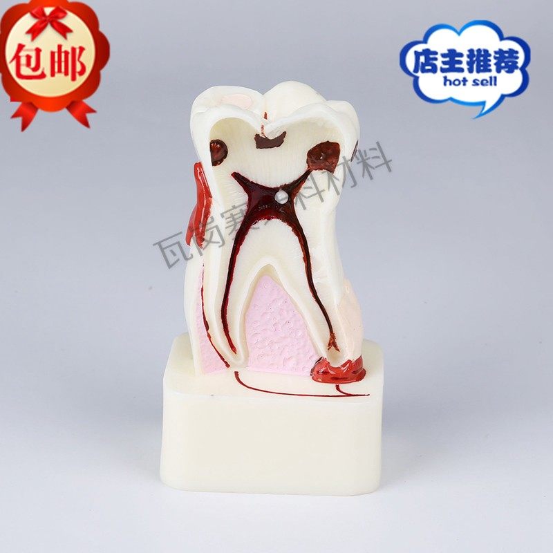 口腔教学模型 4倍牙体综合病理 4倍牙周病综合病理模型 牙齿模型