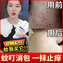 Mosquito Mosquito bite antipruritic ointment Childrens baby special comfrey cream Baby swelling repellent anti-mosquito cream artifact