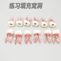 Pratique dexamen dentaire Open Medullary Grain Root Canal Fill Cove Three Tube Resin Off-body Tooth With Medullary Tooth