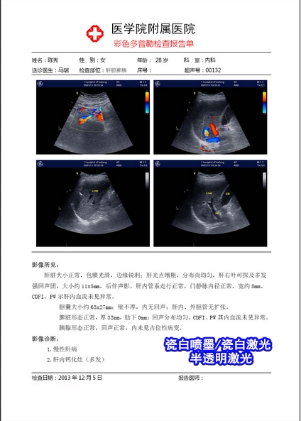 Porcelain white A4 Color inkjet laser negatives paper gastroscopy pathology B ultra-four-dimensional color ultra-hospital with print negatives