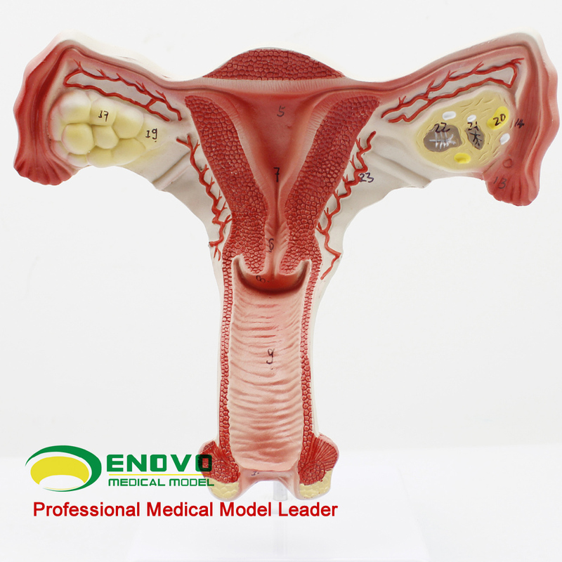 Enovo Yinuo Human Medical Female Uterus Model Gynecological Teaching Aids Ovarian Reproductive Ligament Anatomy Model Gynecology Obstetrics Human Organ Anatomy Tissue Structure Teaching Aids