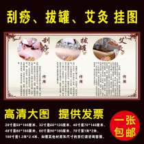 Chinese medicine health beauty salon meridian massage moxibustion cupping scraping body hole map poster wall chart ()