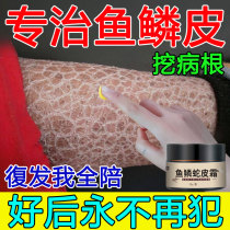 Removing the fish scale Snake God to Chicken Skin Gill Hair Follicles Keratinocytes Keratosis Body Milk Skin Creamy body Men and women