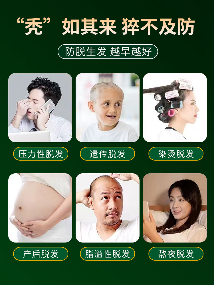 侧柏叶育发精华生发液测评|女生增发密发神器?2025年真实使用体验-其它护发-淘宝好物网