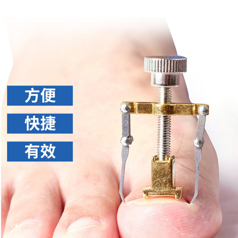 Formalliga Trench embedding meattoenails nail long meats in the German correcting Bundesliga straightener Larra correction