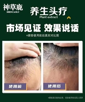 Divine Grass Deer Special Effect Anti-dandruff and Oil Control Shampoo