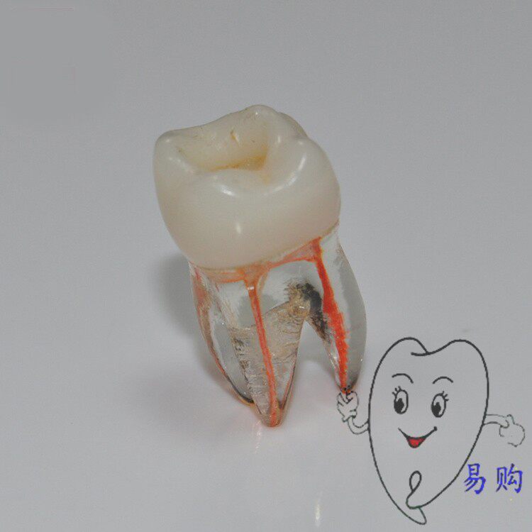 牙科 开髓示范充填根管模型 牙齿髓腔破开备洞去龋腐标准 1个包邮