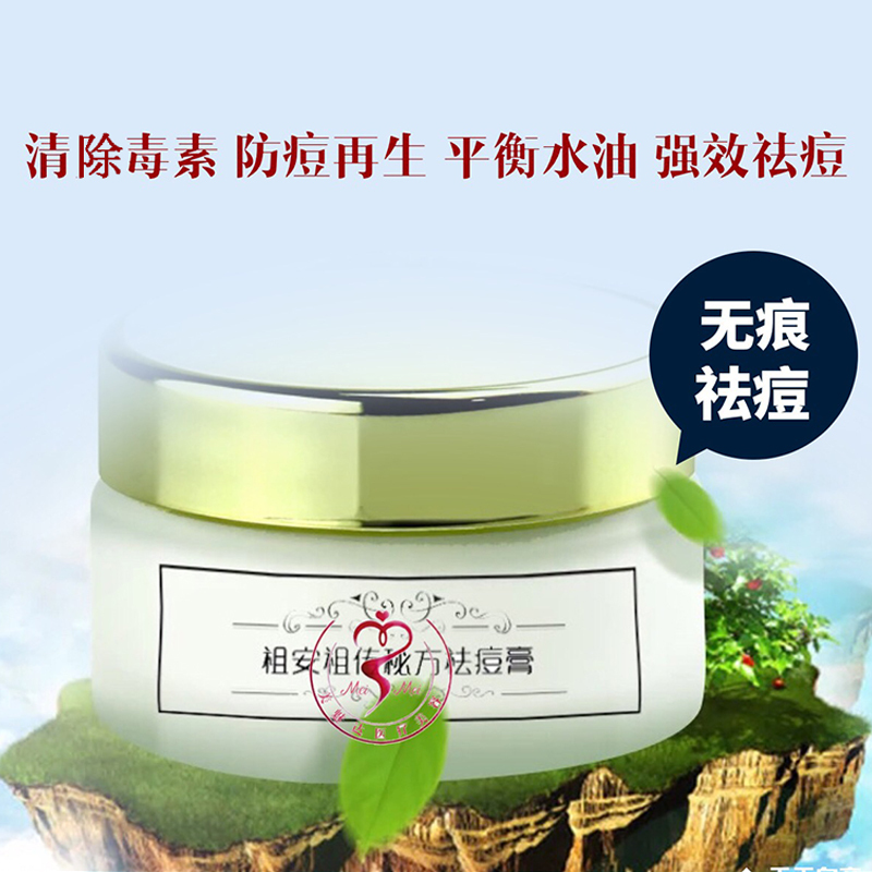 Zuan Acne Cream Domestic Skincare Acne Treatment for Pimples, Closed Comedones, Oil Control Back Acne Cream