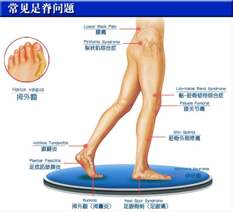 Ku Ming nhập khẩu điều chỉnh đế người lớn chân phẳng valgus đầu gối thoái hóa đau chân hallux valgus trong suốt vòm pad