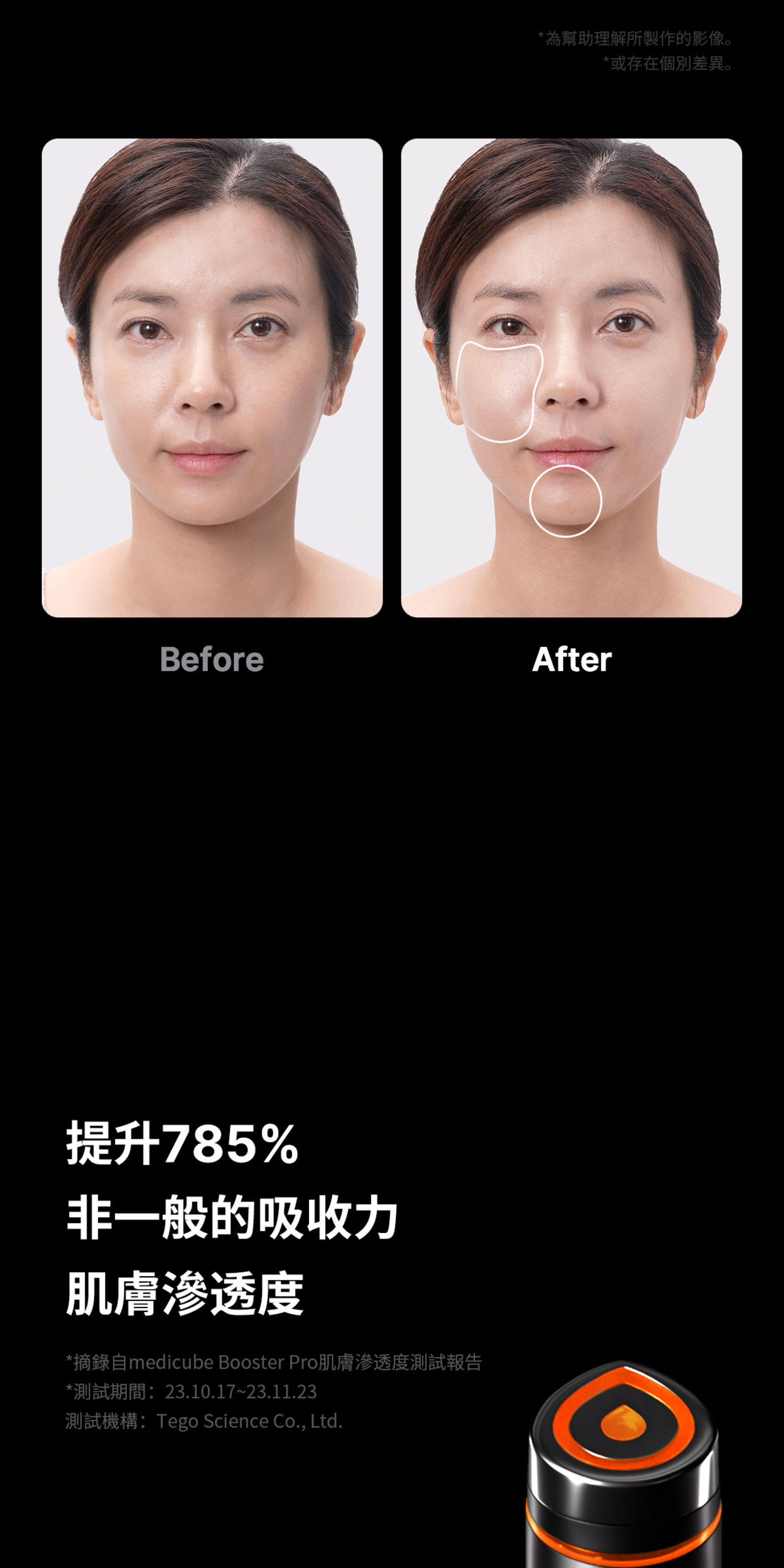 Импорт и экспорт документов 韩国medicube age-r booster pro智慧多功能水光针导入美容机嫩肤