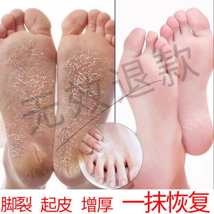 Xiaohongshu recommends hand and foot crack crack heel crack anti-crack crack horse oil hand cream foot care buy 2 get 1 free
