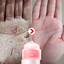 Cracked hands and feet Cracked dry peeling Heel cracked cracked repair cream Summer anti-crack anti-column cream Heel