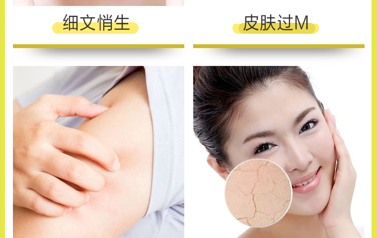 Nhật Bản chính hãng kem dầu ngựa Hokkaido Loshi chính hãng dành cho phụ nữ mang thai trẻ em có thể sử dụng dưỡng ẩm dưỡng ẩm da mặt