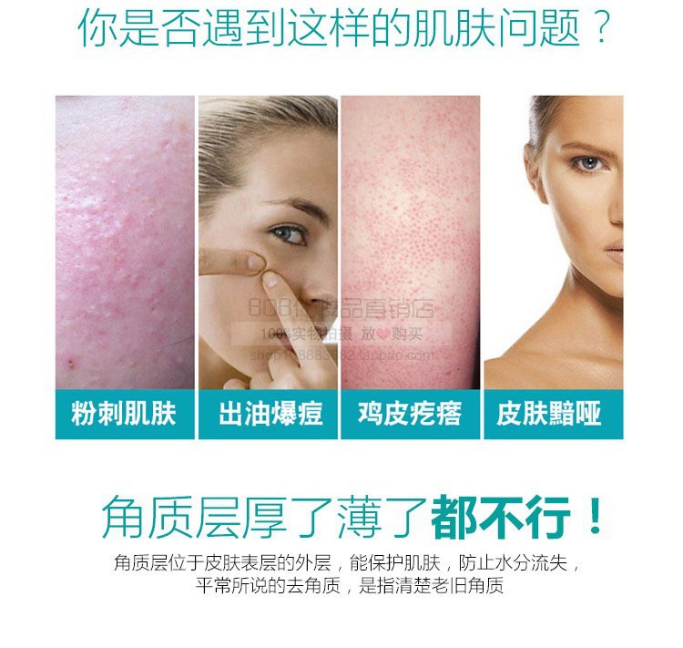 ChunDy Tẩy Tế Bào Chết Mặt Cơ Thể Nam Nữ Mặt Chà Gel Kem làm sạch lỗ chân lông để da chết mụn đầu đen 160 gam tẩy tế bào chết cho da mụn