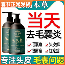 Scalp hair follicles remove mites dandruff inflammation amino acid shampoo dew mite dandruff anti itching oil control cleansing artifact