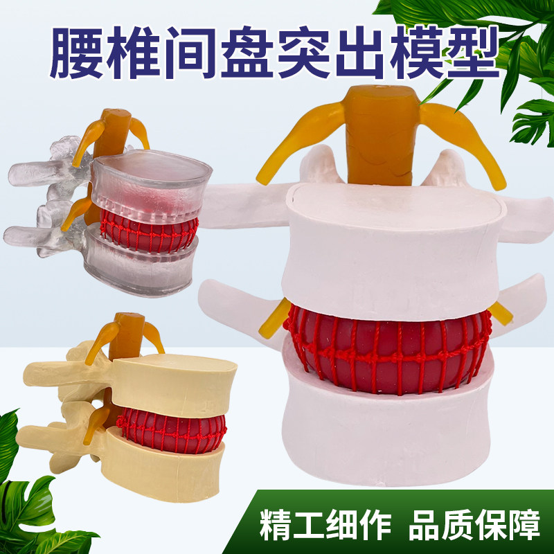 特价腰椎间模型 放大1.5倍 腰椎受压演示模型教学医学 腰椎模型
