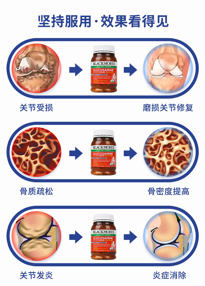 Úc 骨 骨力 blackmores Glucosamine Chondroitin 180 Glucosamine Sản phẩm sức khỏe trung niên - Thức ăn bổ sung dinh dưỡng tảo nhật