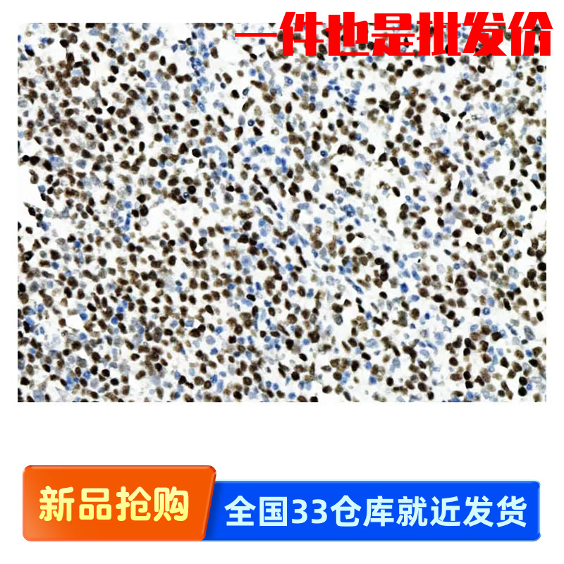 中杉金桥 ZA-0555 cMYC蛋白 c-MYC抗体试剂（免疫组织化学）1.5ml