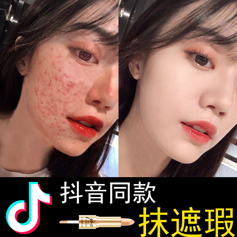 concealer to cover acne