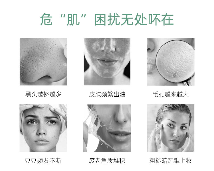 Mặt nạ bùn New Zealand Mystery Volcanic Rock Mud Mask 100ml Kiểm soát dầu Thu nhỏ lỗ chân lông Mặt nạ bùn làm sạch sâu Làm sạch sâu mặt nạ đất sét tốt