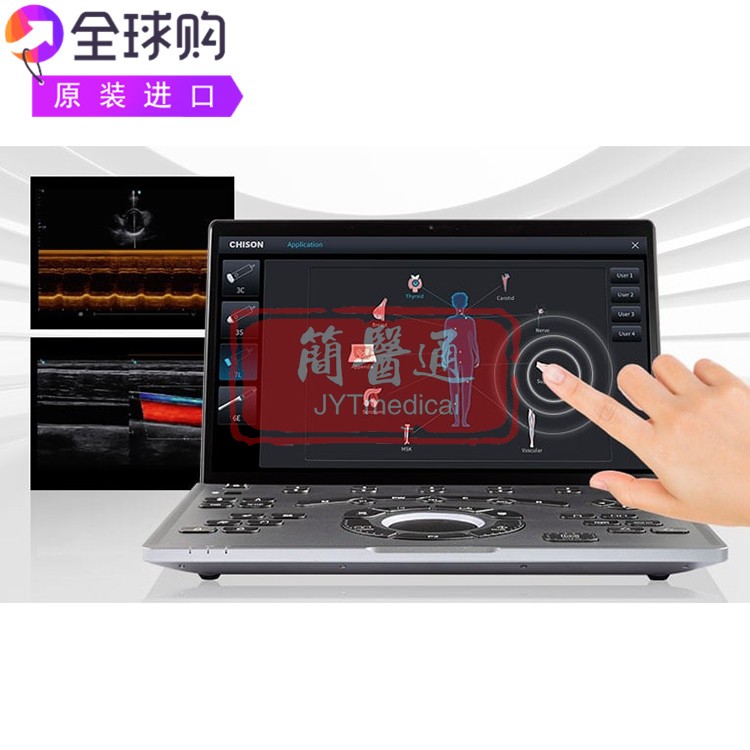 Chison SonoAir 70移动式超薄轻便彩色多普勒临床检查超声仪
