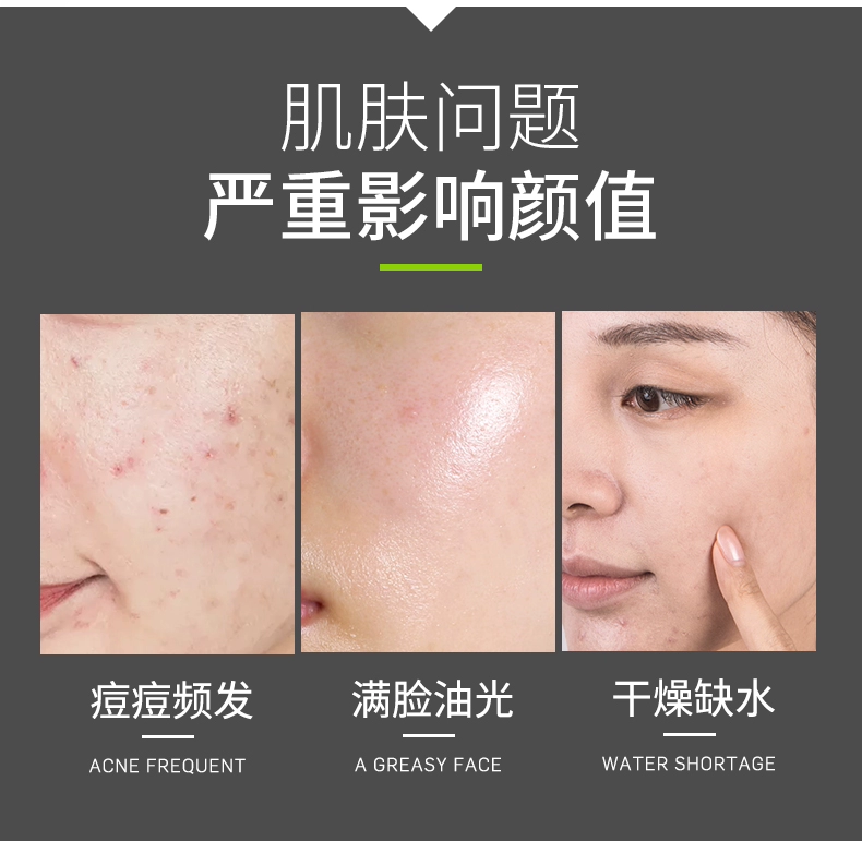 Bác sĩ Li mặt nạ lô hội mụn trứng cá nữ làm mờ vết mụn trứng cá sạch lỗ chân lông sinh viên chính thức - Mặt nạ