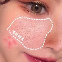 (Recommended by Viya) Small red bottle L-lactic acid shrinking pore essence full face can be used to buy 2 get 1 free