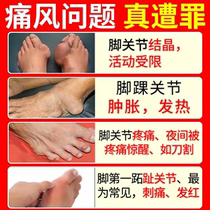 Gout Hand foot Foot Sore Pain Relief New Gout Special Effect Medicine Cold Compress Eurosceptic Autumn Water Fairy Base Flake Uric Acid Special