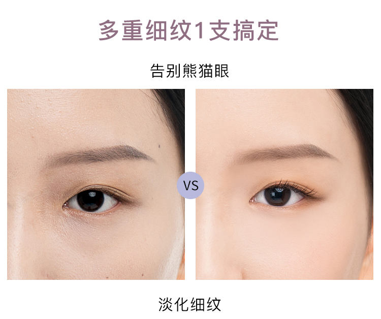 Thắt lưng đầu! Korea Eiio Eye Cream Moisturising Anti-Wrinkle Ăn tối Dark Dark Clip Mắt cực kỳ kem mắt simple