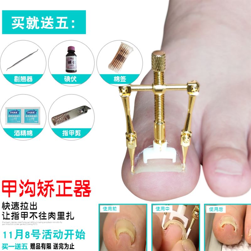 甲沟嵌甲指甲矫正器神器修剪脚趾甲专用指甲刀钳套装工具正甲贴炎