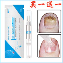 Nail fungus removal special liquid to remove thickening nail nail net drug soft nail cream official website German manicure liquid