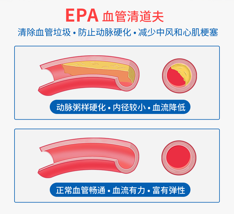 Wow tốt tự nhiên sâu biển dầu mềm viên nang Mỹ gốc Omega omega-3 sản phẩm sức khỏe dha dành cho người lớn 90 viên - Thức ăn bổ sung dinh dưỡng viên vitamin e