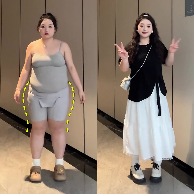Plus Size Casual Suit for Women, New Summer Style, Pear-Shaped Body, Slimming, Belly-Covering, White Skirt Two-Piece Set